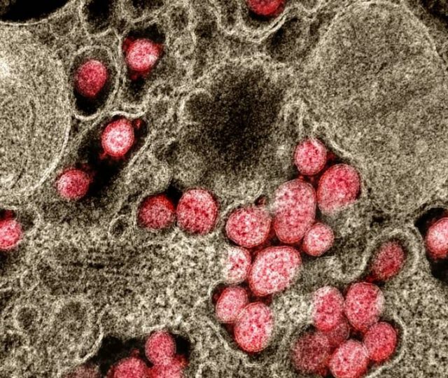 Coronavírus se propaga menos em ambientes secos do que em úmidos, mostra estudo
