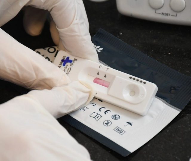 Ministério da Saúde cancelou compra de 14 milhões de testes de antígeno em 2021