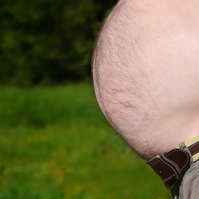 Por que a obesidade é considerada uma doença e não apenas uma questão estética?