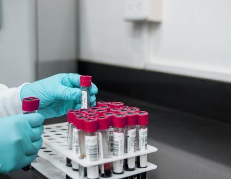 Alzheimer: novo exame que detecta a doença através de amostra do sangue chega ao Brasil