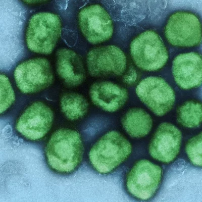 Anvisa aprova registro do 1º teste de diagnóstico de varíola dos macacos no país