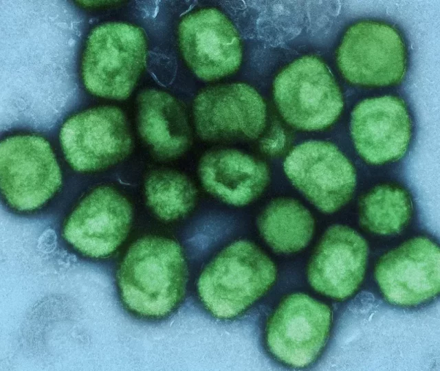 Anvisa aprova registro do 1º teste de diagnóstico de varíola dos macacos no país