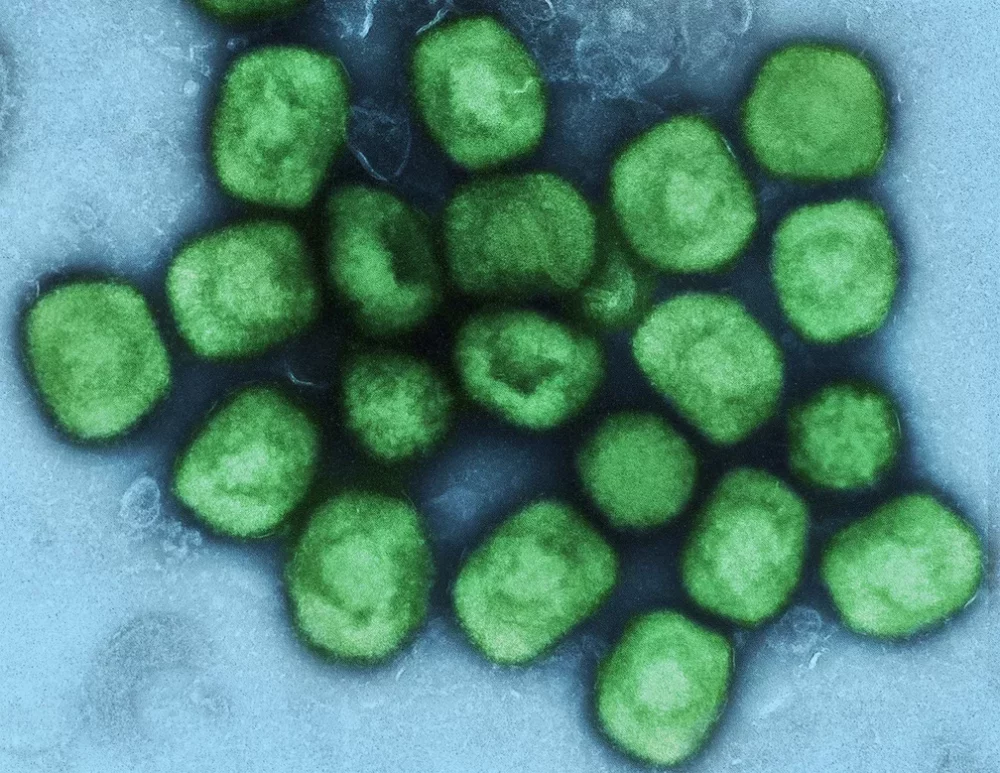 Anvisa aprova registro do 1º teste de diagnóstico de varíola dos macacos no país