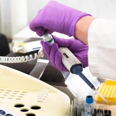 Nova descoberta promete revolucionar o rastreamento de câncer colorretal