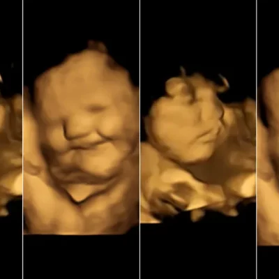 Bebês reagem a sabores de alimentos com expressões faciais ainda na barriga da mãe, mostra estudo inédito