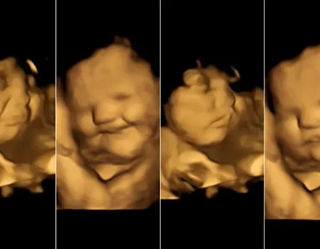 Bebês reagem a sabores de alimentos com expressões faciais ainda na barriga da mãe, mostra estudo inédito