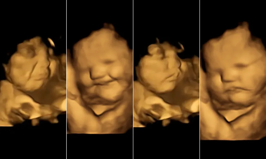Bebês reagem a sabores de alimentos com expressões faciais ainda na barriga da mãe, mostra estudo inédito