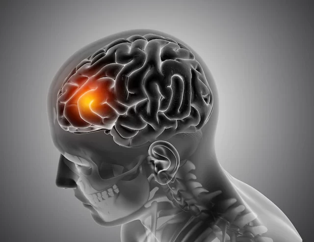 Estudo descobre molécula minúscula no cérebro que pode influenciar o Alzheimer