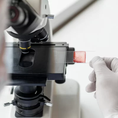 Casos de filariose podem estar ressurgindo no Maranhão