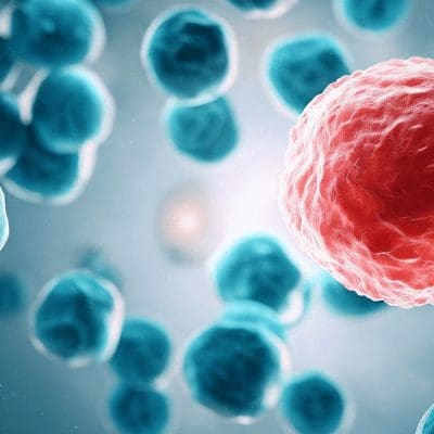 Células T editadas geneticamente eliminam leucemia em pacientes jovens