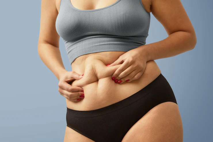 Estudo mostra que a cirurgia bariátrica reduz o risco de câncer hematológico em mulheres obesas