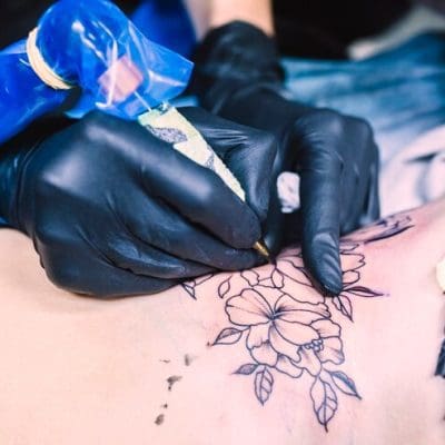 Clínica de dermatologia ajuda vítimas de gangues e tráfico humano a apagar tatuagens indesejadas