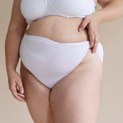Lipedema: conheça a condição que afeta milhões de mulheres no mundo