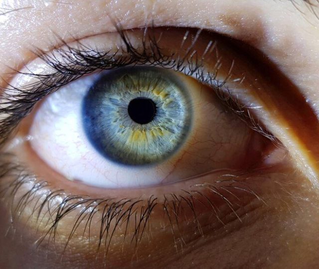 Modelo de aprendizado de máquina pode prever e prevenir a perda de visão em pacientes com alta miopia