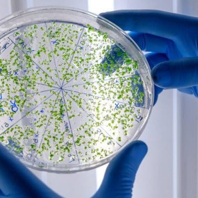 Descoberta que Pode Revolucionar o Tratamento de Infecções Bacterianas