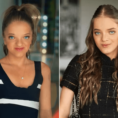 Transformação facial e funcional: o impacto da cirurgia ortognática na vida de Rafa Justus