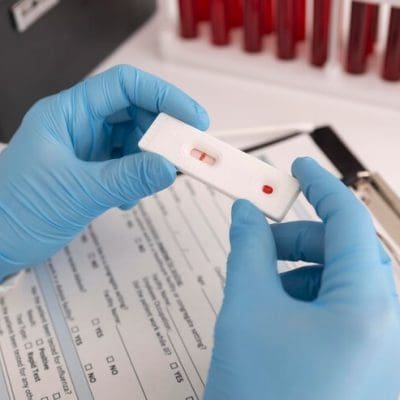 Dengue: Saiba Como os Testes Rápidos Podem Ajudar no Diagnóstico