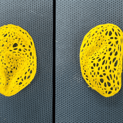 Pesquisadores criam réplica de orelha humana através de impressão 3D