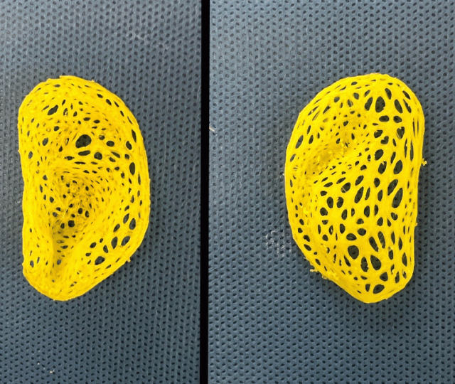 Pesquisadores criam réplica de orelha humana através de impressão 3D