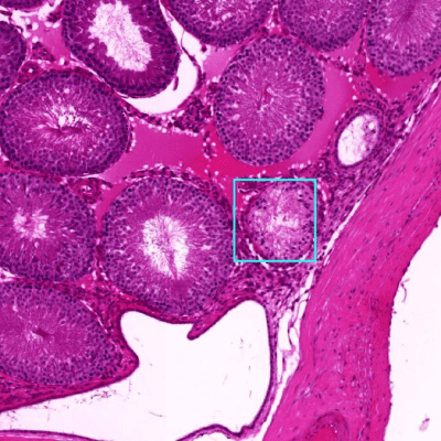Novo sistema de IA consegue diagnosticar doenças em tempo recorde, superando médicos e especialistas