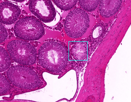 Novo sistema de IA consegue diagnosticar doenças em tempo recorde, superando médicos e especialistas