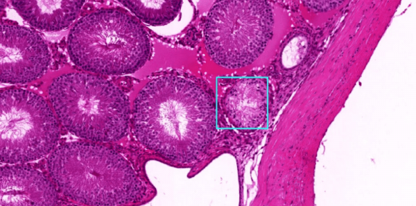 Novo sistema de IA consegue diagnosticar doenças em tempo recorde, superando médicos e especialistas