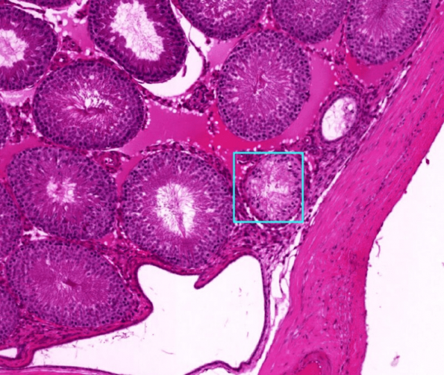 Novo sistema de IA consegue diagnosticar doenças em tempo recorde, superando médicos e especialistas