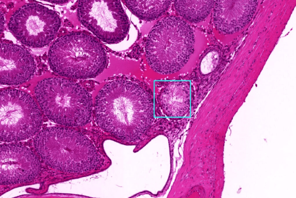 Novo sistema de IA consegue diagnosticar doenças em tempo recorde, superando médicos e especialistas